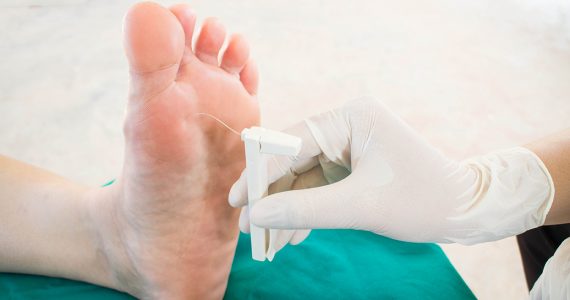 tratamiento para pie diabético